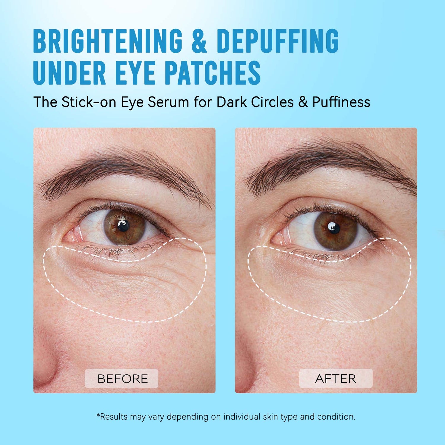 Brightening & Depuffing Under Eye Patches