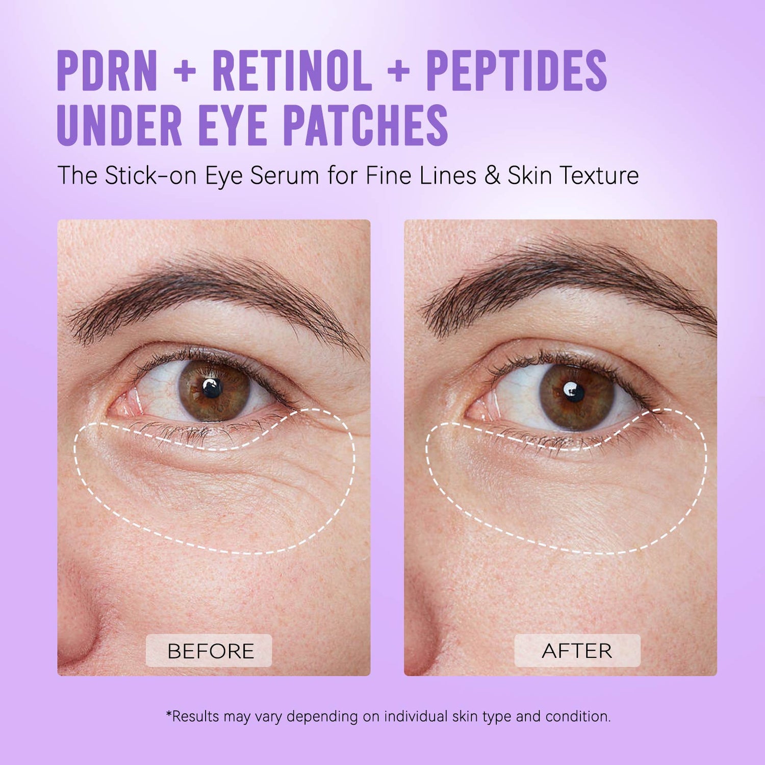 PDRN Retinol Peptides Under Eye Patches